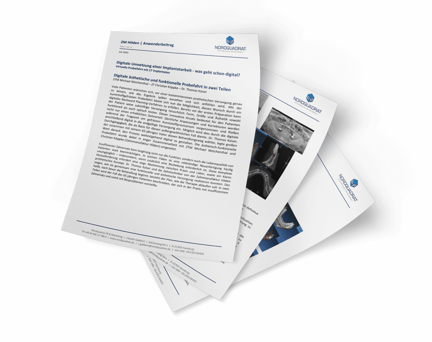 anwenderbeitrag-digitale-implantatarbeit_mockup-02 Zahnmanufaktur Hilden - Hochwertiger und ästhetischer Zahnersatz